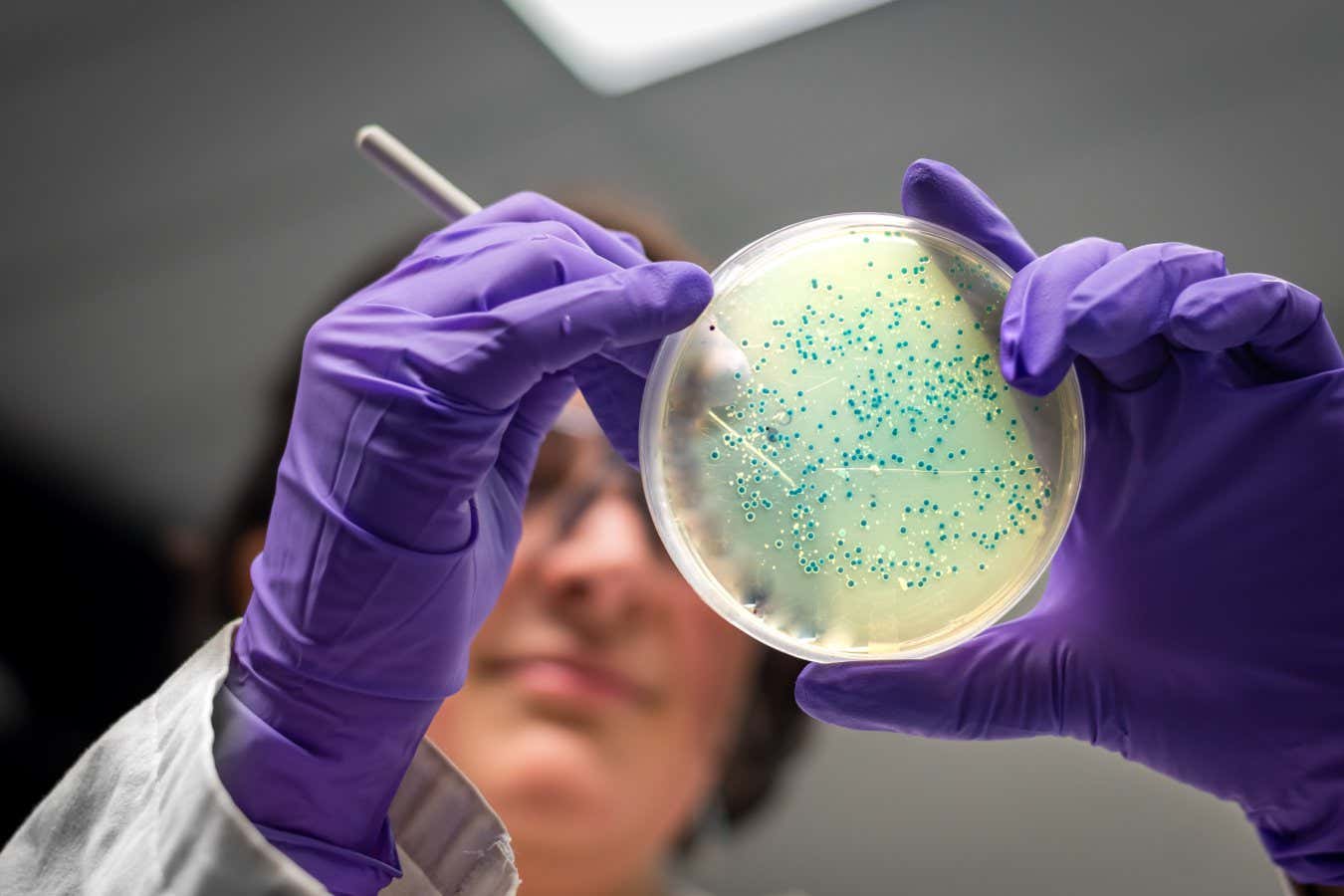 Antibiotic resistance is expected to kill 39 million people by 2050